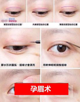 孕眉术